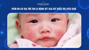 Viêm da cơ địa trẻ em là bệnh gì? Địa chỉ điều trị hiệu quả