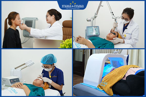 quy trình trị mụn