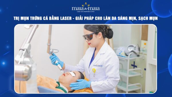 trị mụn trứng cá bằng laser